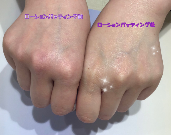 プラセンタがパワーアップ！香椎化粧品【プラスキン ev】 | BLOG